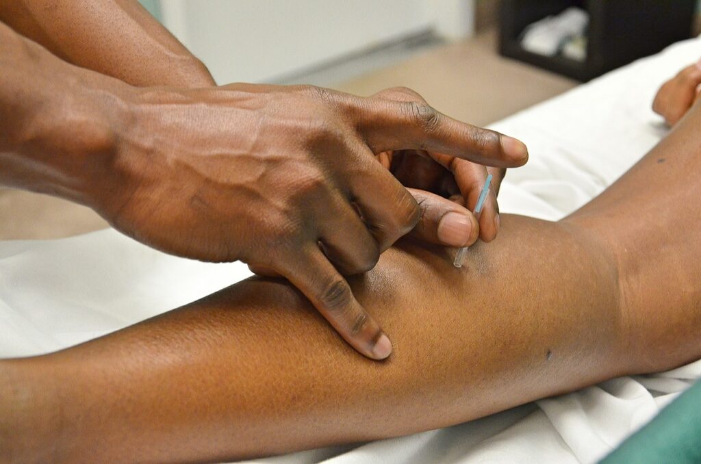 acupuncture and accupressure